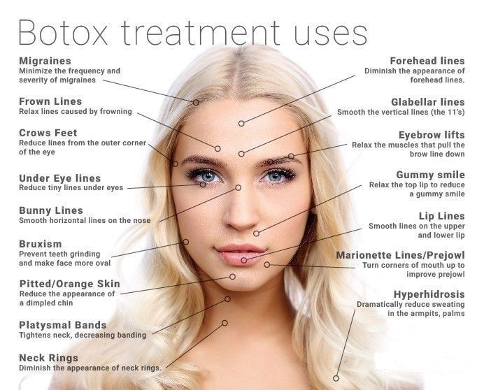 Botox treatment uses