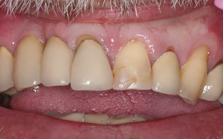 After treatment