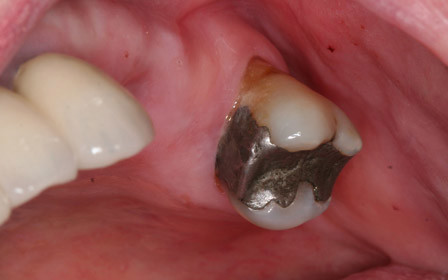 Before treatment
