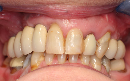 After treatment