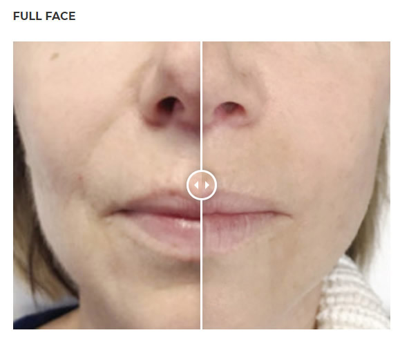 Full Face