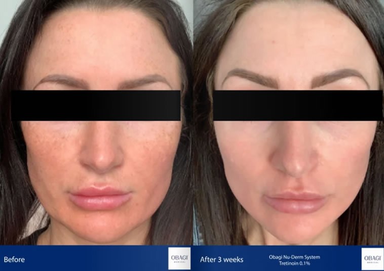 Obagi skin care